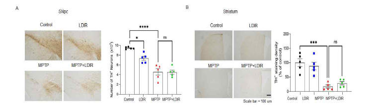 TH 양성 도파민 신경세포 IHC 결과 (A) 흑질 (B) 선조체