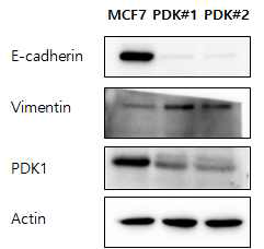 MCF7 세포와 PDK1 KD 세포에서 EMT marker 발현 확인