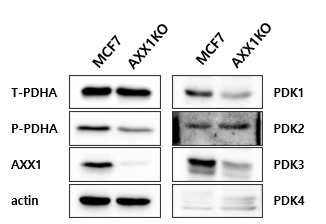 비전이 암세포 MCF7 세포와 AXX1 KO 세포 내 대사 효소 발현 비교분석