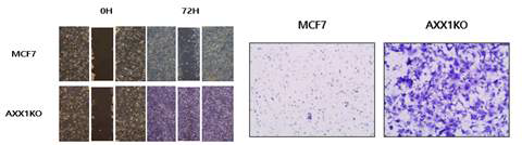 MCF7 세포와 AXX1 KO 세포에서 Wound healing, invasion assay