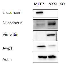 MCF7 세포와 AXX1 KO 세포에서 EMT marker 발현 확인