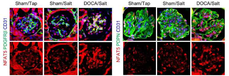 DOCA/Salt hypertensive mouse model의 사구체의 Mesangial cells에서 NFAT5 발현이 증가함을 확인함. (Unpublished data)