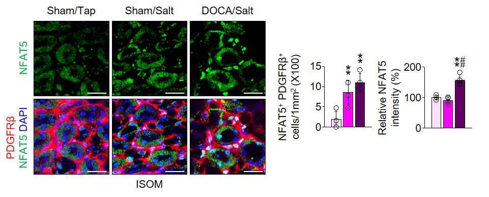 DOCA/Salt hypertensive mouse model 을 확립하고, Interstitial fibroblast에서 NFAT5가 Upregulation 됨을 확인함