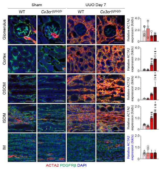 Unilateral ureteral obstruction mouse model 을 확립하고, 신장 섬유화의 Phenotype을 확인함. (Unpublished data)