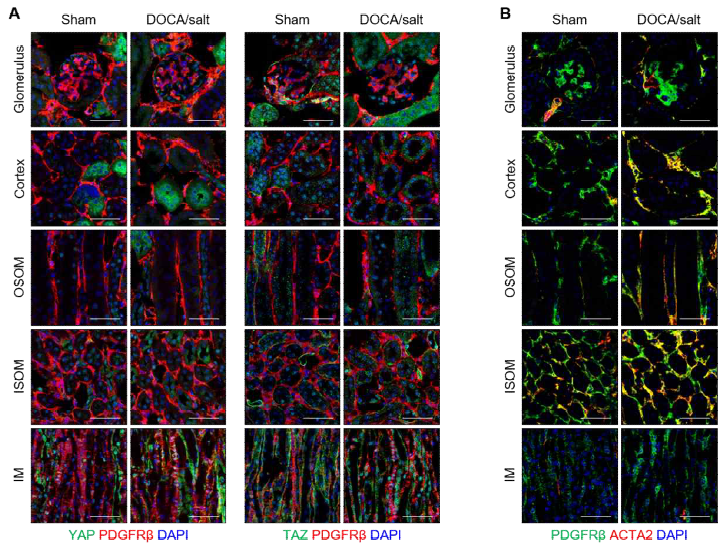 DOCA/salt-induced hypertensive mouse에서 Inner medulla의 Fibroblast에 특이적으로 Hippo pathway 활성화 (Unpublished data)
