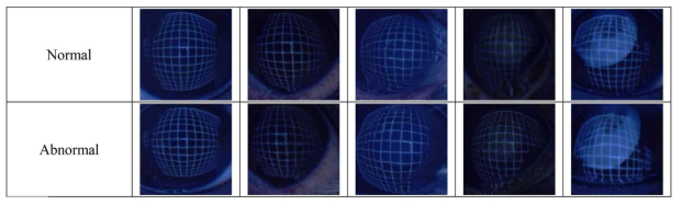 AI 딥러닝을 위한 image labeling (normal and abnomal의 예)