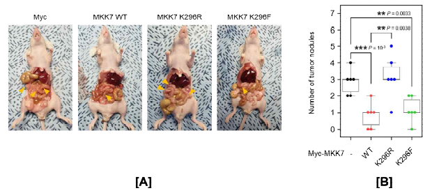 A MKN-1 세포주에 비메틸화 MKK7 돌연변이체를 도입한 후, 실험용 생쥐에 이식하고 암의 진행 을 관측함. B xenograft 후 희생하여 전이된 위암 결절의 수를 확인함