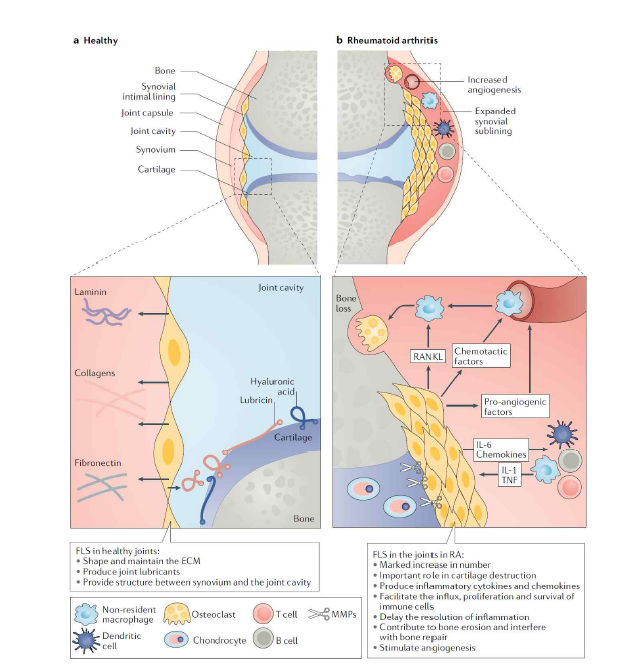 류마티스관절염 발병기전의 주요 원인인 FLS 메커니즘 [Nat Rev Rheumatol. 2020 Jun;16(6):316-333.]