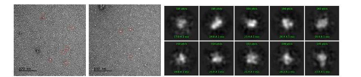 HPV E7−인간 단백질 복합체 Negative staining 전자현미경 분석 결과