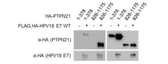 면역침강법을 활용한 HPV18 E7-PTPN21 신규 결합부위 확인