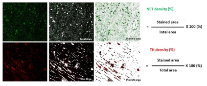 병리조직에서 면역형광염색을 통해 심근 교감신경의 기능적 탈신경화를 나타내는 NET 밀도와 해부학적 탈신경화를 나타내는 TH 밀도를 계산하기 위한 측정(ImageJ) 및 계산