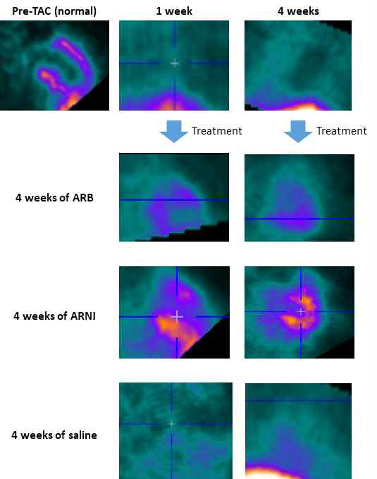 치료군과 대조군 사이의 TAC을 시행한 후 완전히 사라졌던 심근의 섭취가 4주간 ARB, ARNI, saline (vehicle) 처치 후 약물치료 군에서만 저명하게 회복됨을 확인하였음