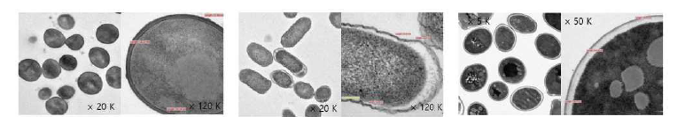 TEM을 이용한 세포 및 세포벽 측정.왼쪽부터 S. aureus, S. Enteritidis, S. cerevisiae.