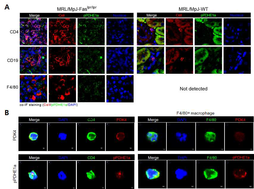 루푸스 마우스 모델 신장 조직과 오줌 세포 co-IF 염색 결과 (A) MRL/lpr 마우스 신장 조직 p-PDHE1a (초록색)과 각종 면역세포 마커 (빨간색) co-IF 염색 (B) Pristnae-induced lupis like 마우스 모델 오줌 유래 면역세포 PDK4와 p-PDHE1a 발현양 분석