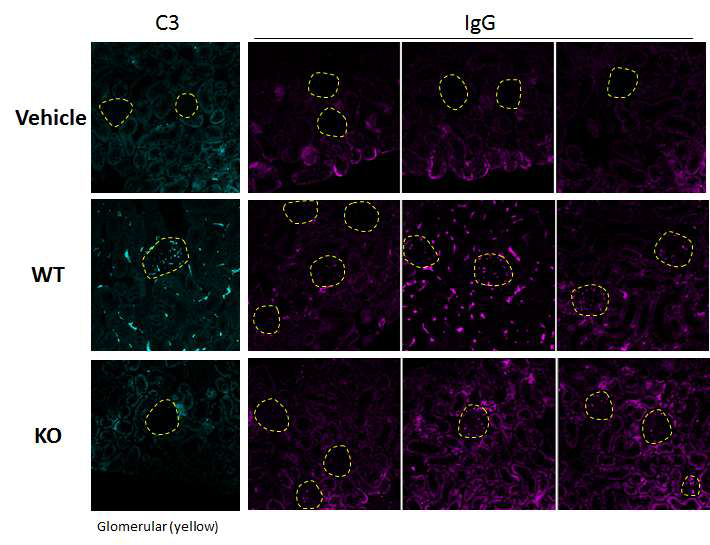 신장의 C3와 IgG 염색을 통한 사구체-신장염 분석
