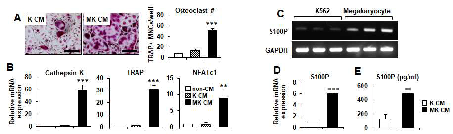 MK 분화시 배양액 (MK CM)에 의한 파골세포 분화 증대 (A) 및 분화마커 발현 증대 (B) 확인. MK에 서의 증가한 S100P mRNA 발현 (C,D) 및 MK CM에 포함된 증가한 S100P 단백질량 (E).