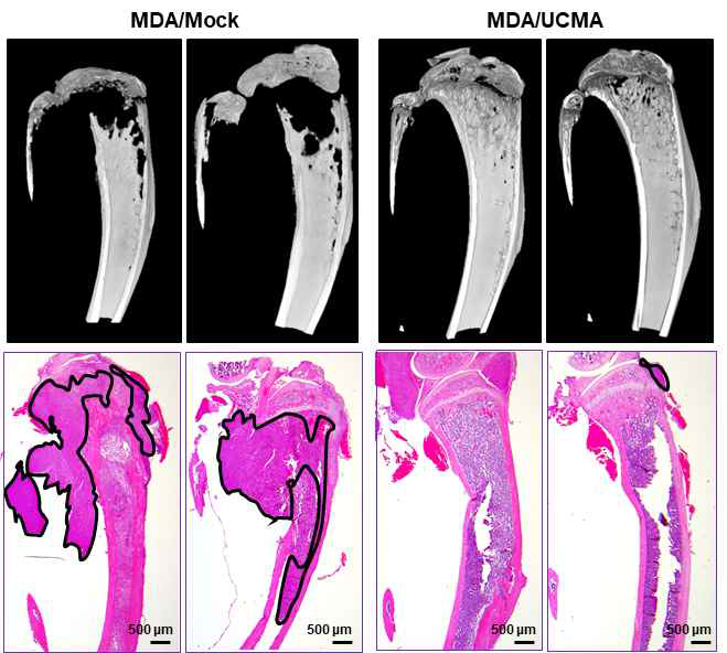 골합병증 마우스 모델 (intratibial injection)에서 Ucma 과발현 유방암세포 (MDA/Ucma)에 의한 골파괴 저해 효과 확인. (아래쪽 골조직 H&E 사진내의 검은 선은 암세포 군집을 나타냄)