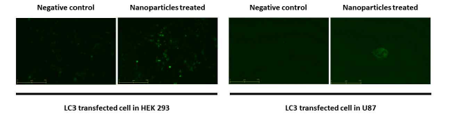 LC3 tasfenction된 세포에서 나노파티클 처리 후 autophagy 변화 관측