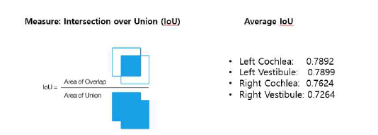 전문의와 AI prediction한 결과를 IoU를 계산한 결과 평균 0.76 이상의 높은 일치도를 보임