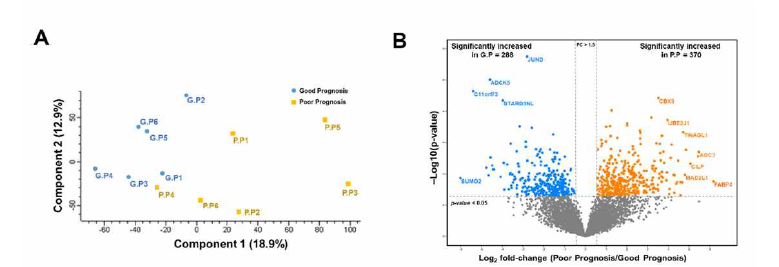 Statistical and functional differences between good and poor prognosis groups: (A) principal component analysis (PCA); (B) volcano plot