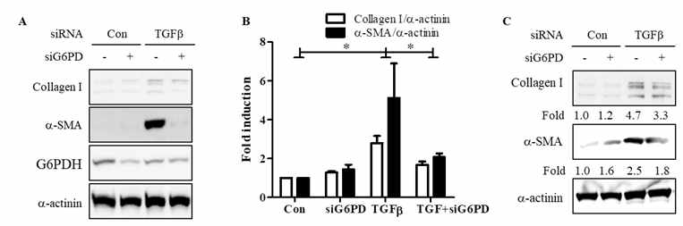 G6PD의 siRNA 효과. A. MRC5 세포의 대표 western blot. B. colagen과 α-SMA 양. C. IPF 환자로부터 유래된 primary fibroblasts의 western blot.