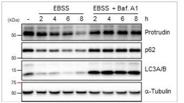 오토파지 유도에 의한 protrudin의 분해