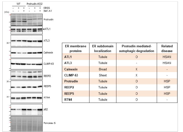 Protrudin에 의해 매개되는 tubular ER 단백질의 특이적 분해