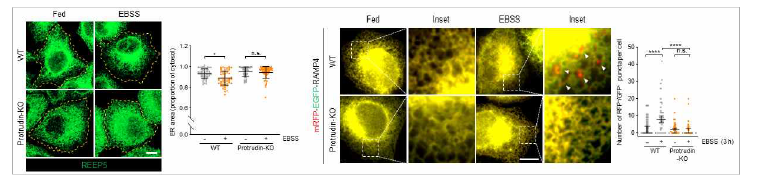 ER-phagy assay 시스템 구축 및 protrudin에 의한 ER-phagy세부 조절 기전 규명