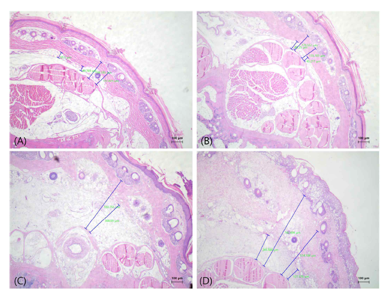 Typical example photographs of Hematoxylin & Eosin (H&E) stained Histological findings of the rat tails were stained with H&E. (A) Normal rat tail model injected with Indocyanine green (ICG). (B) Normal rat tail model injected with Indocyanine green-methylene blue (ICG-MB). (C) 1 week after the surgery, findings in rats tail injected with ICG. H&E staining revealed thickening of the subcutaneous tissue layer after surgery. Significant increase of the adipose tissue was checked. (D) 1 week after the surgery, findings in rats tail injected with ICG-MB. No significant difference was observed in the histological findings of the group injected with ICG and the group injected with ICG-MB