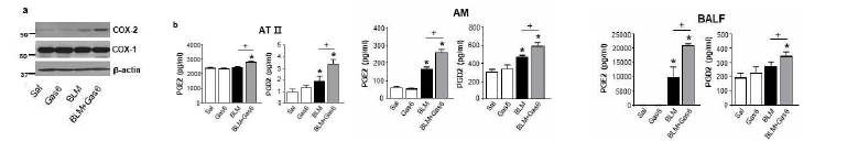 Gas6 투여시 COX-2 단백질발현과 PGE2 및 PGD2 생성이 증가됨. (a) Western blot을 이용하여 폐조직에 서 COX-2, COX-1 단백질 발현을 나타냄. (b) ELISA를 이용하여 일차 AT II 및 폐포대식세포 배양액, BALF에서 PGE2 및PGD2 수준을 나타냄.