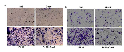 Gas6 투여시 일차 ATII 세포와 폐섬유아세포의 침윤 능력이 억제됨. (a) ATII와 (b) 폐섬유아세포의 침윤 능력