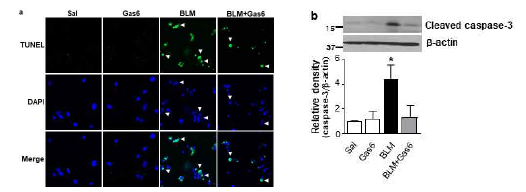 Gas6 투여에 의한 ATII 사멸 억제 작용 (a) 일차 ATII 세포에서 TUNEL assay (b) 폐조직에서 cleaved capase 3 발현 정도를 면역 블랏으로 분석