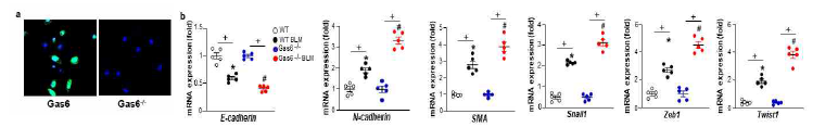 Gas6-/- 마이스의 ATII 세포에서 BLM 투여 후 EMT 관련 인자들의 mRNA 발현 변화가 더 강화됨. (a) 일차 ATII 세포에서 면역형광염색을 통한 Gas6 발현 검증. (b) ATII 세포에서 EMT 관련 인자들의 mRNA 발현을 qRT-PCR로 분석함