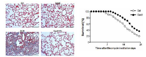 BLM 투여 21일에 trichrome 염색시 Gas6의 in vivo 투여(50/kg/day, i.p.) 군에서 (왼쪽) 폐 섬유화 및 손상 정도가 감소됨. (오른쪽) 생존률도 개선 됨.