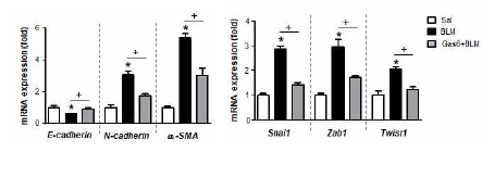 Gas6의 in vivo 투여(50 μg/kg/2 day, i.p.)에 의한 EMT 마커 및 조절 전 사인자의 mRNA 변화