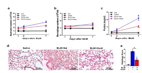 Gas6 투여에 의한 bleomycin-유 도 폐염증 억제 작용. (a,b) Neutrophil and alveolar macrophage numbers in BAL fluid. (c) Total protein levels in BAL fluid were analyzed by protein assay kit. (d) Hematoxylin–eosin stains of lung sections at 7 days after BLM (original magnification: ×200). Scale bars: all 20 μm. (e) Histology score of lung inflammation at 7 days after BLM treatment.