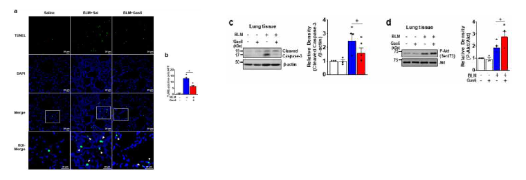 Gas6 투여에 의한 bleomycin-유도 폐세포 사멸 억제 작용. (a) Representative TUNEL−stained fixed tissue section (original magnification: ×200). (b) Quantitation of the number of TUNEL−positive cells (number/HPF) in the different groups. (c,d) Immunoblot analysis of the indicated proteins