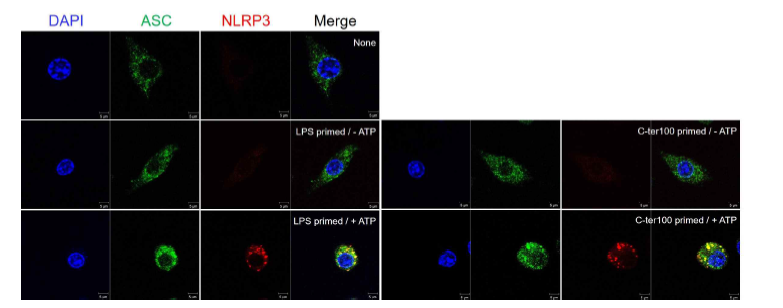 Immunofluorescence detection of NRLP3 and ASC by confocal microscopy.