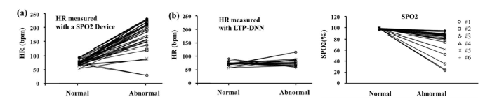 정상 측정 데이터와 비정상(동잡음 포함) 측정데이터에 대해 LTP-DNN이 정상 비정상으로 판정한 데이터간의 비교 (좌) 기존 측정 장치에서 전송한 심박수 (중) LTP-DNN에 의해 측정된 심박수 (우) 기존 측정 장치가 전송한 SPO2