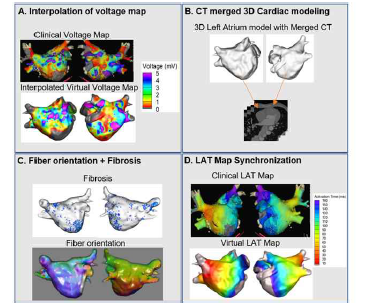 3차원 심방모델의 제작과정 (Hwang I, Pak hn, et al. Frontiers in physiology 12 (2021))1