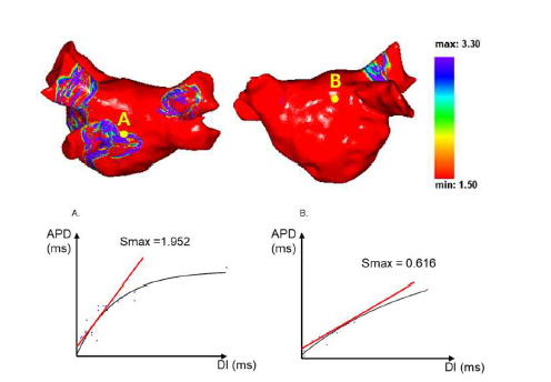 심방의 각 지점 (40-50만개 node)에서 동시, 동일한 조건으로 상환현상 평가가 가능해짐 (위) Smax 지도 (아래) 각 지점에서의 상환현상 곡선과 상환현상 곡선 최대기울기 값인 Smax 값 (Park JW et al.,Front Cardiovasc Med. 2022 Mar 3)3