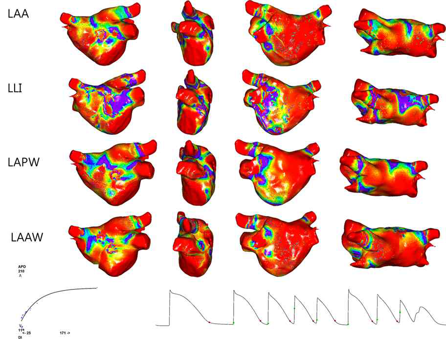 상환현상 Smax 맵핑. 심방에 대한 램프 조율을 네곳에 서로 다른 부위에서 시행하면서 심방세동이 유발되는 순간의 가장 높은 Smax 부위 를 컬러맵으로 표시함. 청색 부위가 높은 Smax의 부위임. 네곳의 심방조율 위치: LAA, left atrial appendage (좌심방이), LLI, left lateral isthmus (좌측협부), LAPW, left atrial posterior wall (좌심방 후벽), LAAW, left atrial antarior wall (좌심방 전벽).