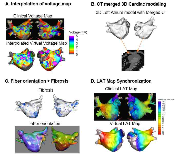 환자의 Realistic AF 3D model 제작 방법 (Hwang I, Pak hn, et al. Frontiers in physiology 12 (2021))1