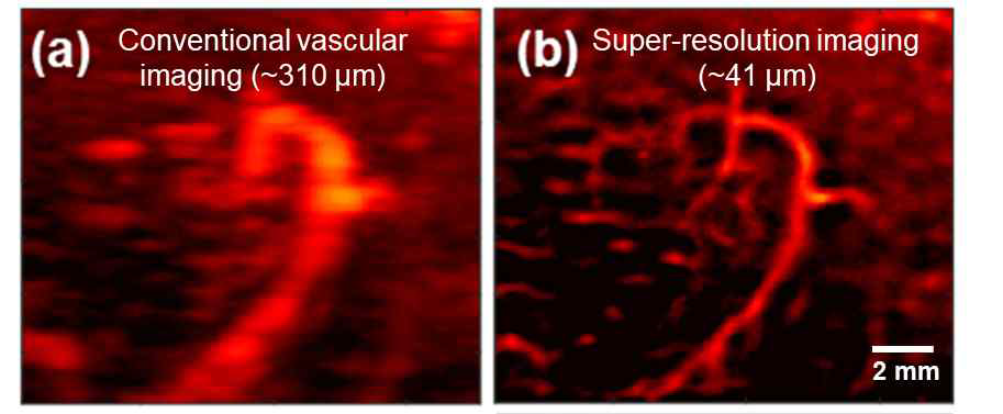 개발된 초해상도 영상의 해상도. 7 MHz 중심주 파수를 가지는 트랜스듀서를 활용한 초음파 시스템 상에서 41 μm를 달성함. (목표치 50 μm)