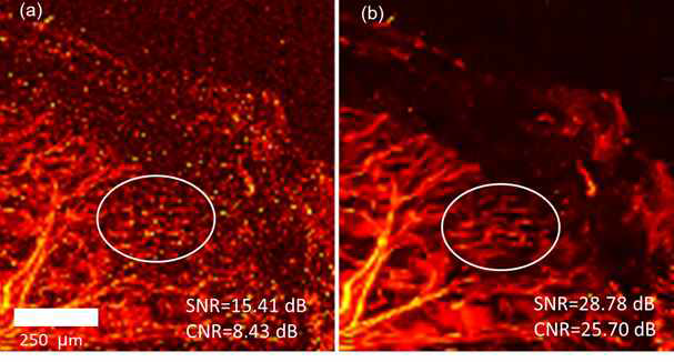 개발된 적응형 다중스테이지 노이즈 억제 기술이 적용된 in vivo 영상 (a) 기본 광음향 영상 (b) 제안된 기술 이 적용된 광음향 영상