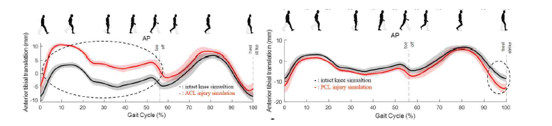 전방 십자인대 부상 시뮬레이션 (왼쪽), 후방 십자인대 부상 시뮬레이션(오른쪽)
