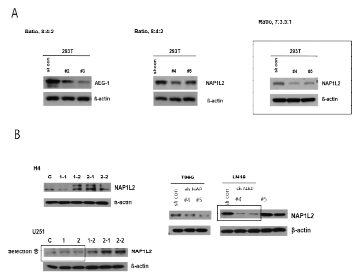 NAP1L2의 발현조절 시스템 확립함(A)NAP1L2 과발현시스템확립을 위한 최적농도를 선정함. (B)신경 교종세포주에서 NAP1L2의 과발현 시스템을 확립함