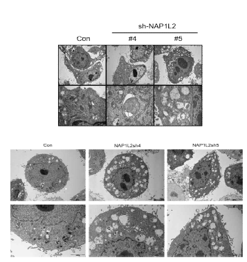 Transmission electron microscopy(TEM) -투과전자현미경을 통해 autophagy 발생 시 형성되는 autolysosomes을 관찰함. NAP1L2의 발현 저해 시 autolysosomes 형성이 증가함을 확인함.