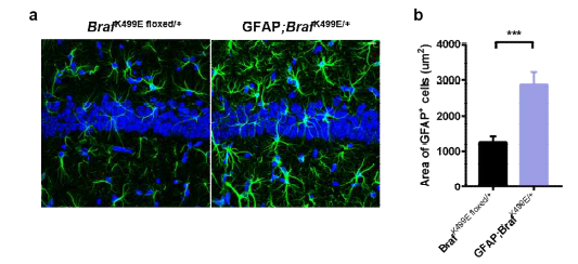 성상교세포 특이적 BRAF K499E 발 현이 GFAP 발현에 미 치는 영향 a,b 해마 부 위에서 GFAP의 발현.