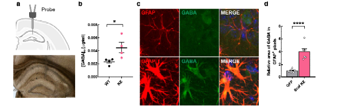 성상교세포 특이적 BRAF K499E 생쥐에서 GABA 증가 a,b 간질액 성분에서의 GABA 증가 c,d 성 상교세포에서의 GABA 증가